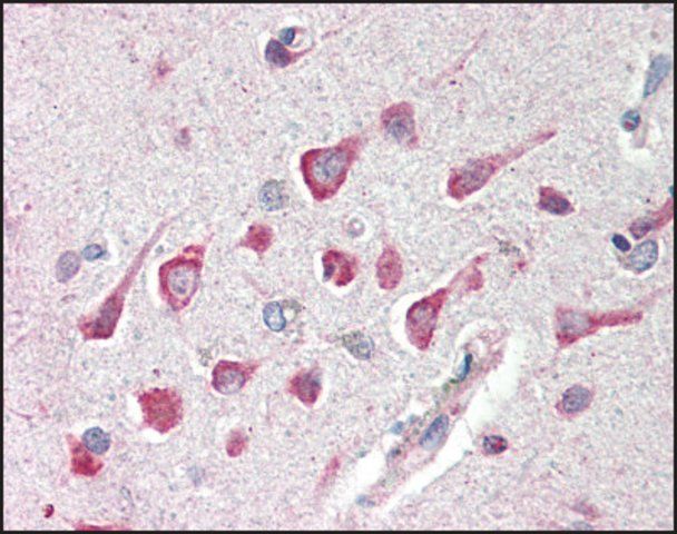 Anti-CTRP4 antibody produced in rabbit