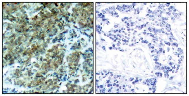 Anti-CTTN (Ab-466) antibody produced in rabbit