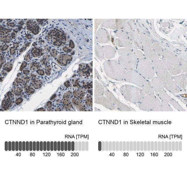 Anti-CTNND1 antibody produced in rabbit