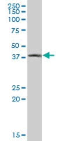 Anti-CTSE, (C-terminal) antibody produced in mouse