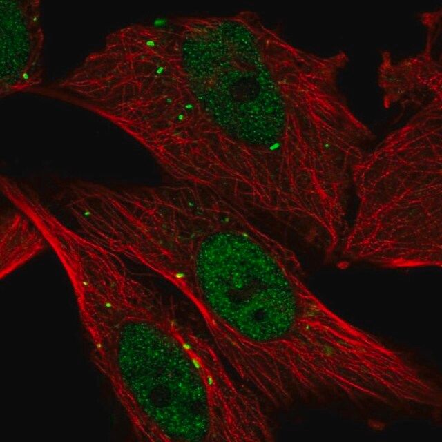 Anti-CTSC antibody produced in rabbit