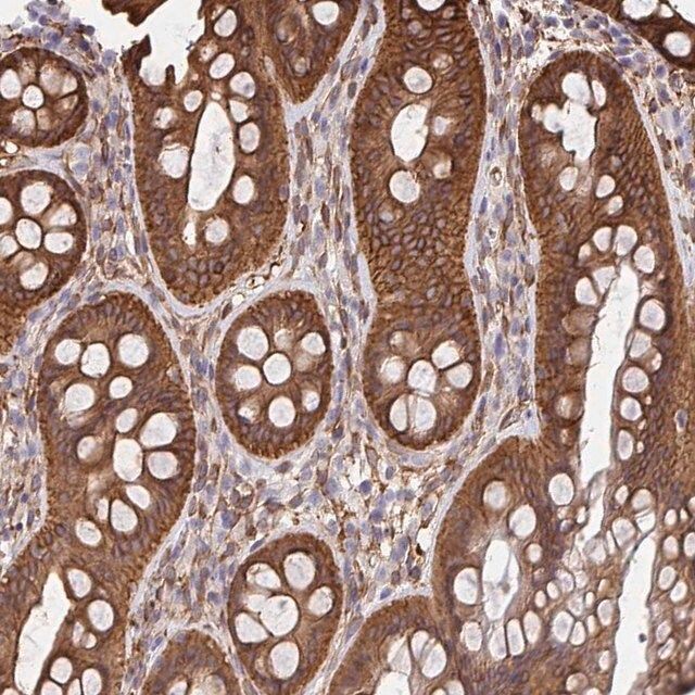 Anti-CTTN antibody produced in rabbit