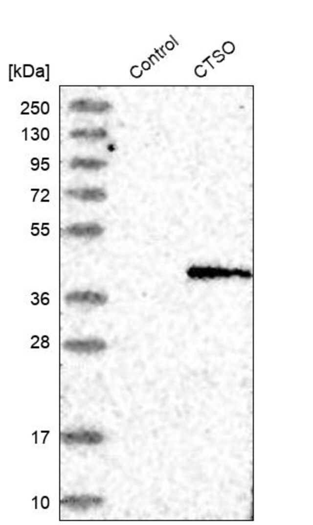 Anti-CTSO antibody produced in rabbit