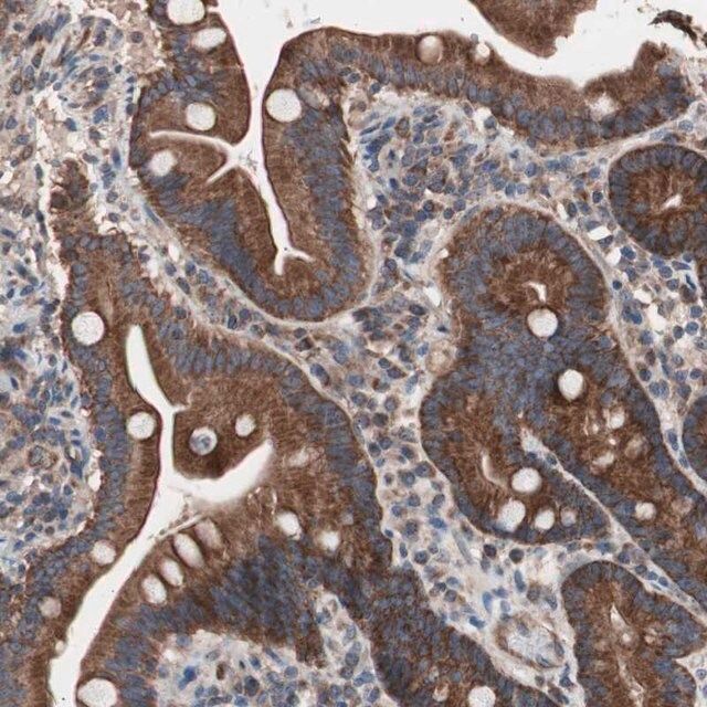 Anti-CTTNBP2NL antibody produced in rabbit