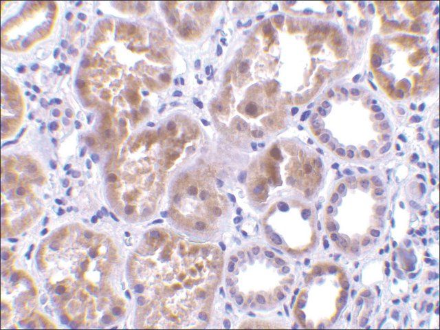 Anti-CTRP1 (ab2) antibody produced in rabbit