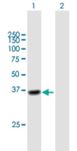 Anti-CTSL1 antibody produced in mouse