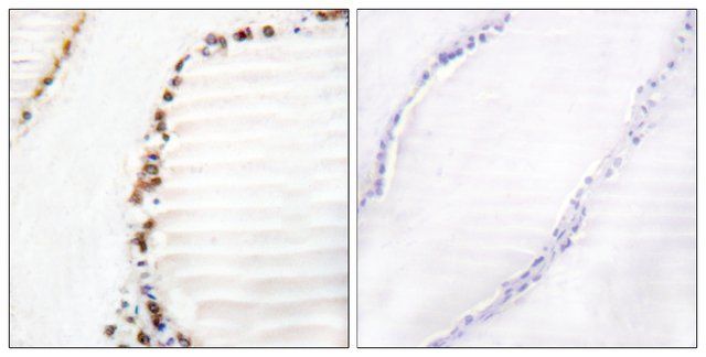 Anti-Cullin 3 antibody produced in rabbit