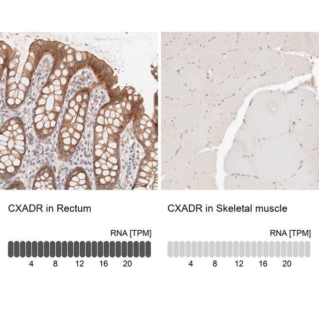 Anti-CXADR antibody produced in rabbit