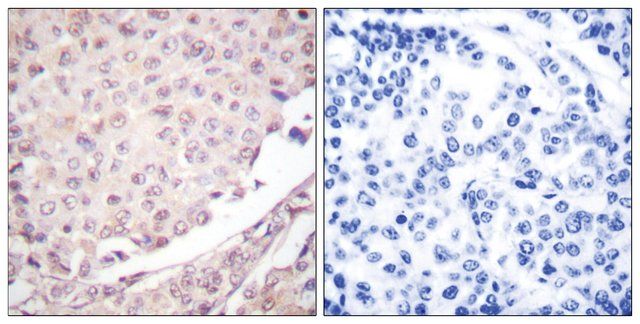 Anti-Cullin 1 antibody produced in rabbit