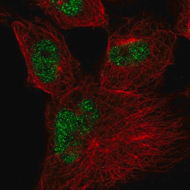 Anti-CWC27 antibody produced in rabbit