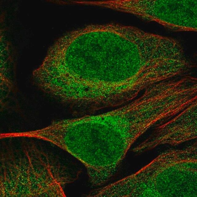 Anti-CUEDC2 antibody produced in rabbit