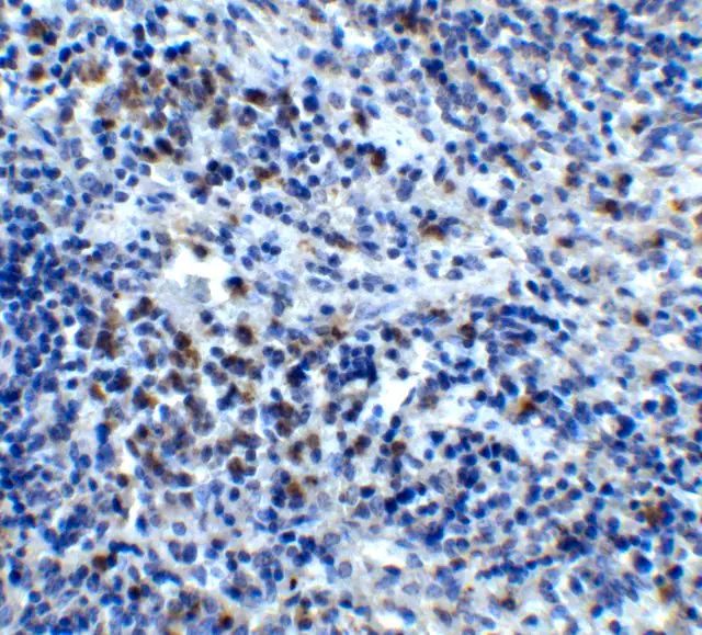 Anti-CXCR4 antibody produced in rabbit