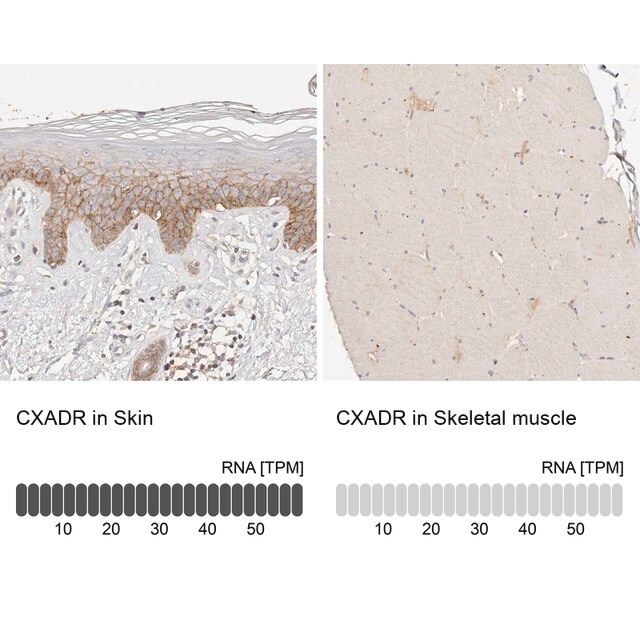 Anti-CXADR antibody produced in rabbit