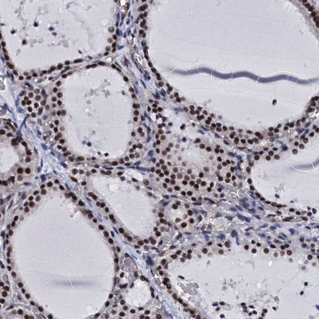 Anti-CWC15 antibody produced in rabbit