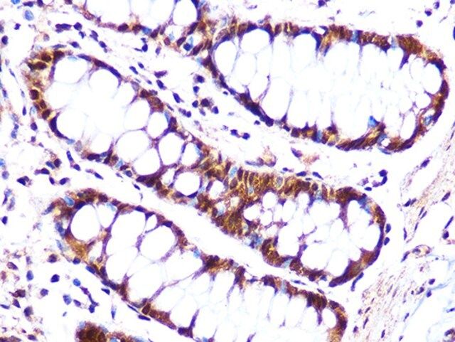 Anti-Cullin 4A antibody produced in rabbit