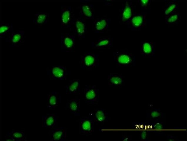 Anti-CUX1 antibody produced in mouse