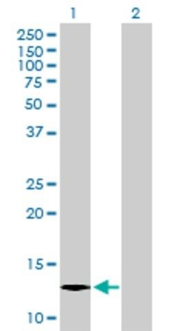 Anti-C1ORF38 antibody produced in mouse