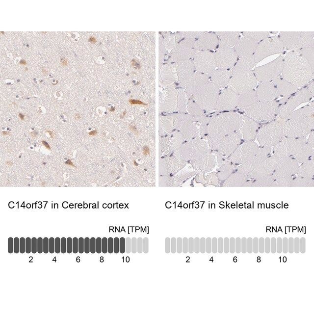 Anti-C14orf37 antibody produced in rabbit