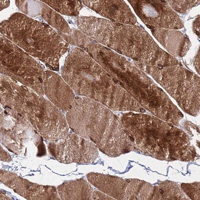 Anti-C5orf34 antibody produced in rabbit