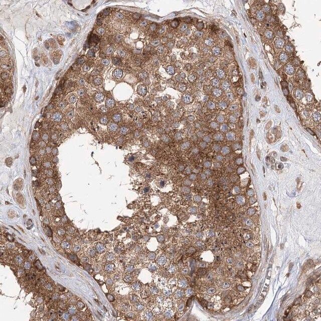 Anti-C12ORF4 antibody produced in rabbit