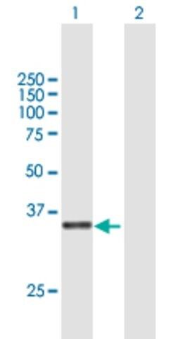 Anti-C3ORF38 antibody produced in mouse