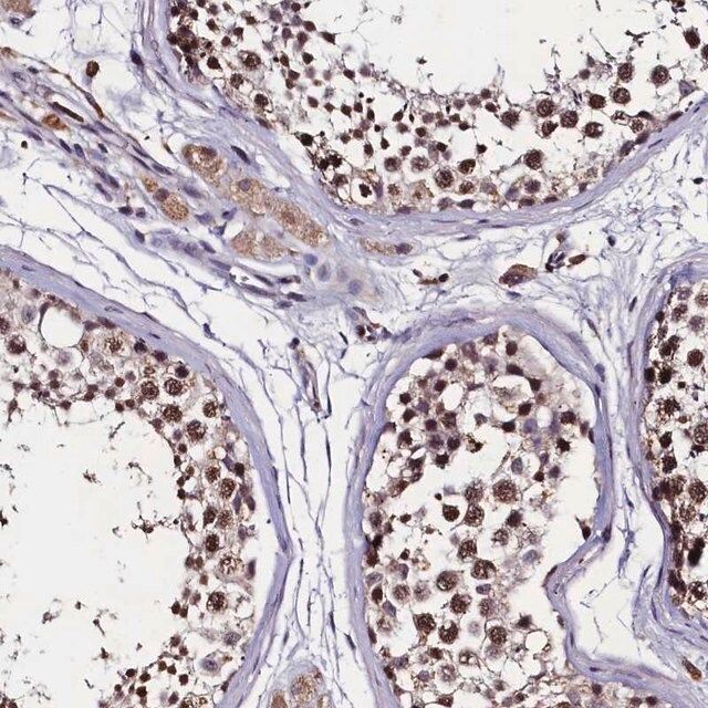 Anti-C11orf49 antibody produced in rabbit