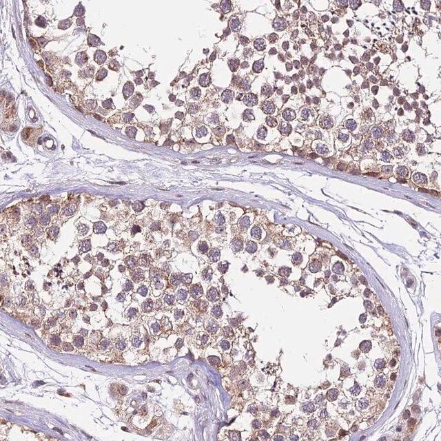 Anti-C4orf47 antibody produced in rabbit