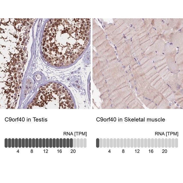 Anti-C9orf40 antibody produced in rabbit