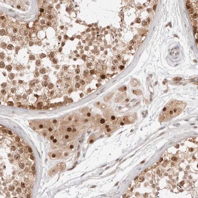 Anti-C8orf48 antibody produced in rabbit