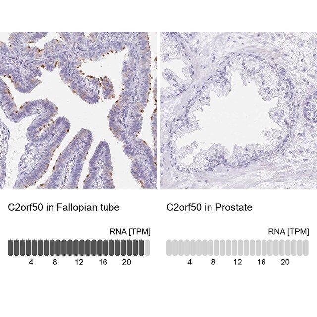 Anti-C2orf50 antibody produced in rabbit