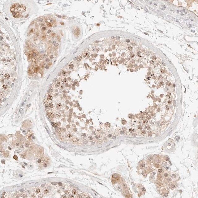 Anti-C17orf47 antibody produced in rabbit