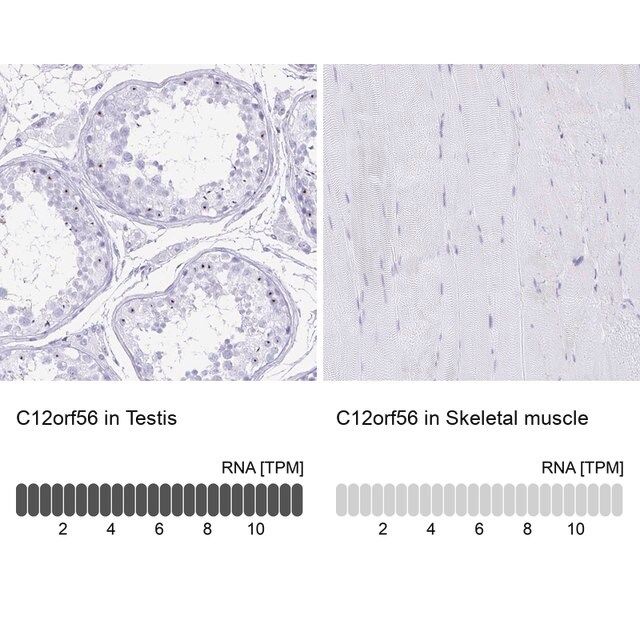 Anti-C12orf56 antibody produced in rabbit