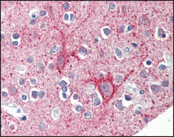 Anti-C12orf5 antibody produced in rabbit