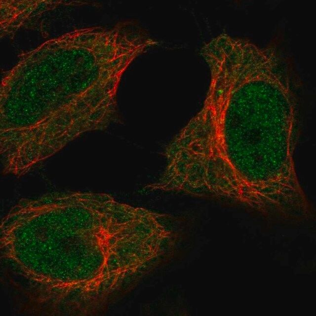 Anti-C5orf51 antibody produced in rabbit