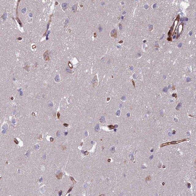 Anti-C15orf59 antibody produced in rabbit