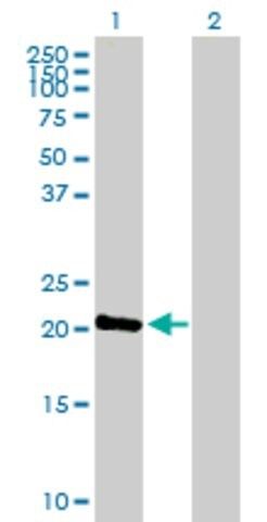 Anti-C1ORF57 antibody produced in mouse