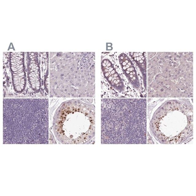 Anti-C1orf56 antibody produced in rabbit