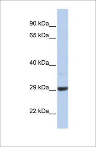 Anti-C10ORF56 antibody produced in rabbit