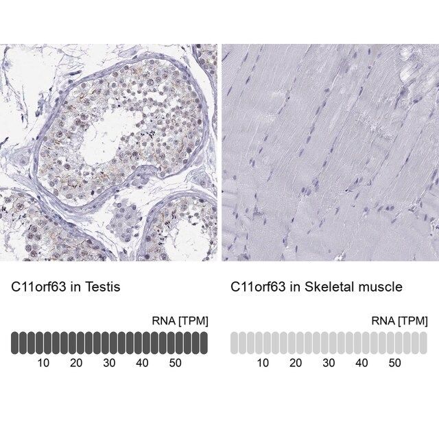 Anti-C11orf63