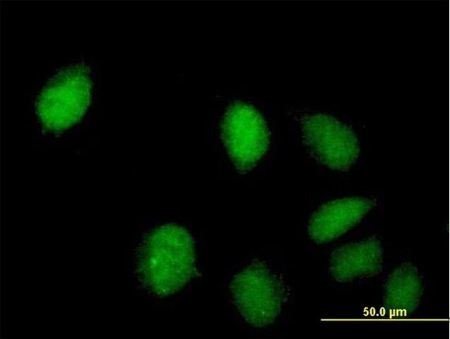 Anti-C8ORF70 antibody produced in mouse