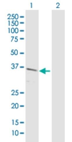 Anti-C10orf59 antibody produced in rabbit