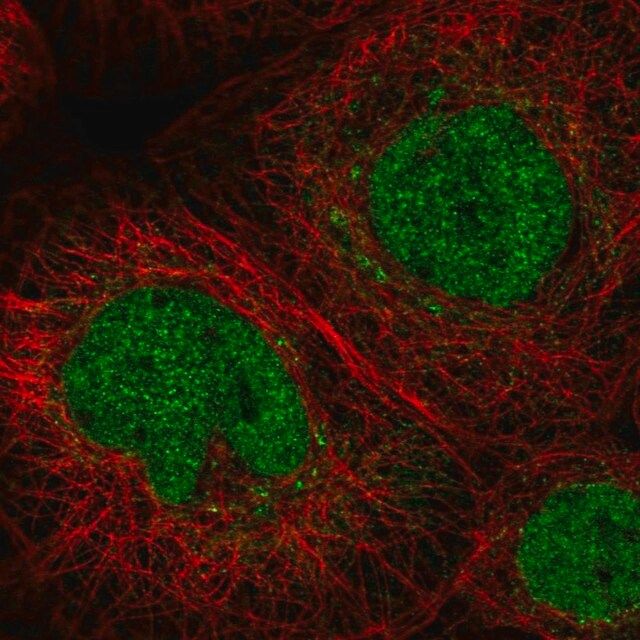 Anti-C11orf63 antibody produced in rabbit