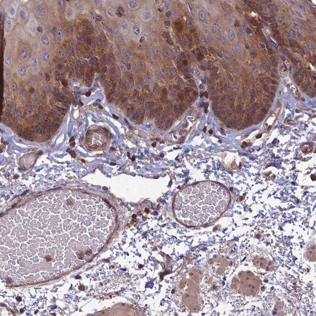 Anti-C15orf62 antibody produced in rabbit