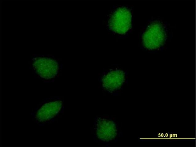 Anti-C17orf66 antibody produced in mouse