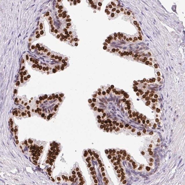 Anti-C2orf71 antibody produced in rabbit