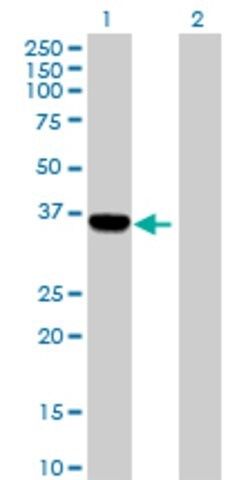 Anti-C1ORF80 antibody produced in mouse