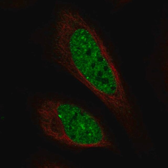 Anti-C11orf71 antibody produced in rabbit