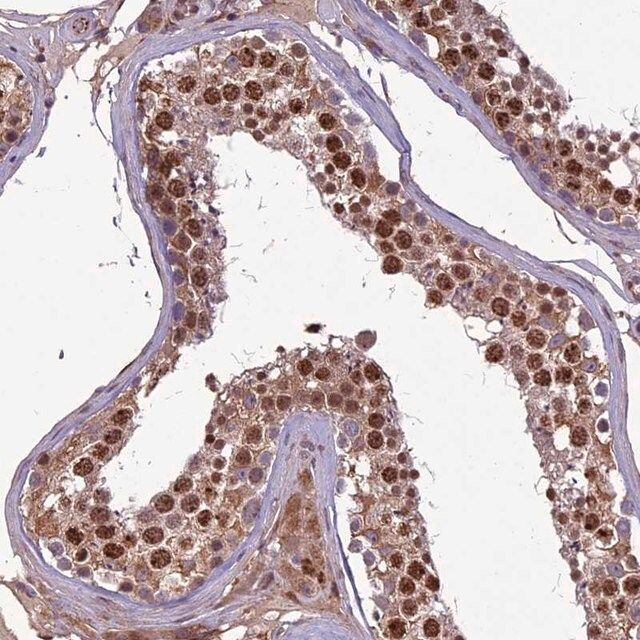 Anti-C3orf70 antibody produced in rabbit