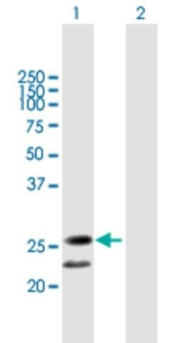 Anti-C20ORF71 antibody produced in mouse