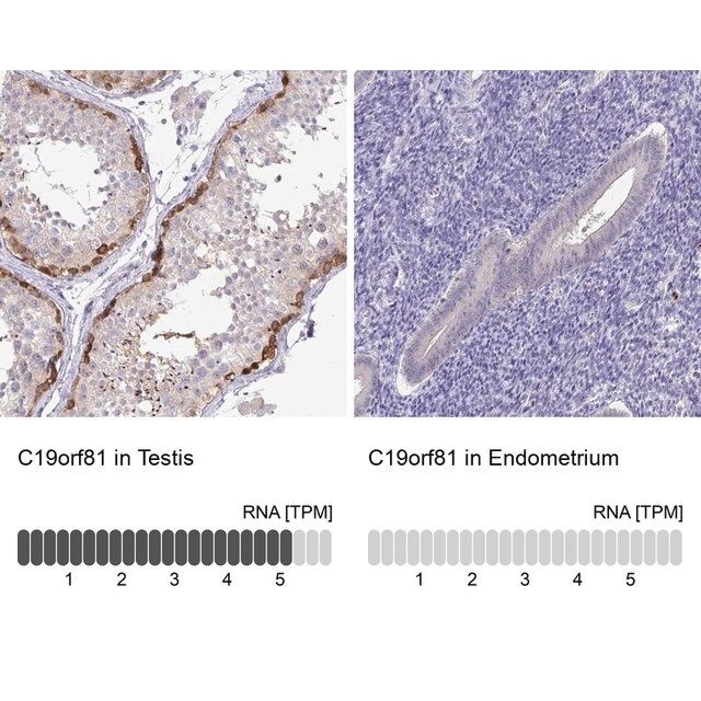 Anti-C19orf81 antibody produced in rabbit